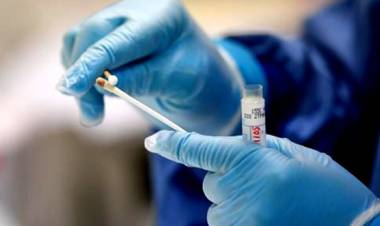 INFORME COVID DEL DÍA 9 DE AGOSTO