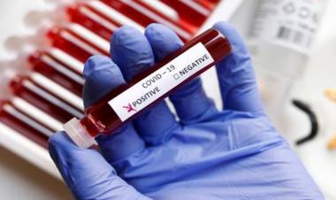 Un nuevo caso positivo de COVID-19 en la ciudad de Arroyito , con este suman tres. 